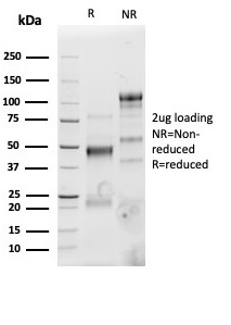 SDS-PAGE Analysis Purified CD4 Recombinant Rabbit Monoclonal Antibody (CD4/3619R). Confirmation of Purity and Integrity of Antibody.
