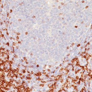 Formalin-fixed, paraffin-embedded human tonsil stained with CD5 Mouse Monoclonal Antibody (C5/473).