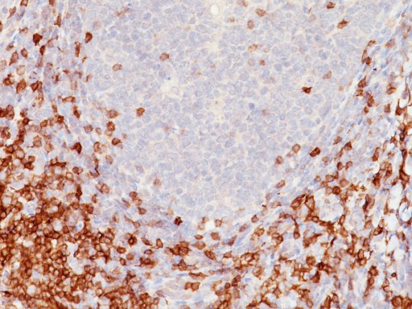 Formalin-fixed, paraffin-embedded human tonsil stained with CD5 Mouse Monoclonal Antibody (C5/473).
