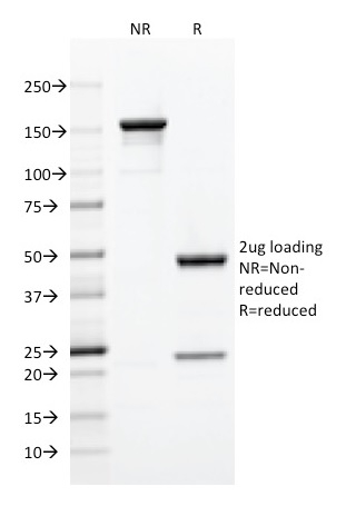SDS-PAGE Analysis of Purified CD5 Mouse Monoclonal Antibody (C5/473). Confirmation of Integrity and Purity of Antibody.