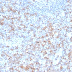 Formalin-fixed, paraffin-embedded human tonsil stained with CD5 Recombinant Mouse Monoclonal Antibody (rC5/6462).