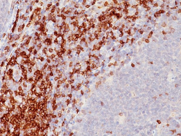 Formalin-fixed, paraffin-embedded human Tonsil stained with CD5 Monoclonal Antibody (SPM546)