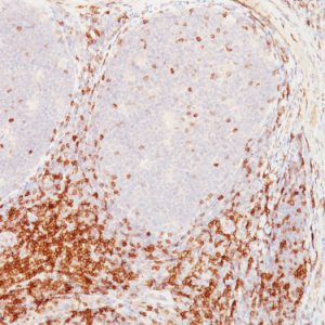 Formalin-fixed, paraffin-embedded human Tonsil stained with CD5 Mouse Monoclonal Antibody (CD5/54/F6).