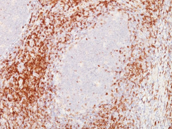 Formalin-paraffin human Tonsil stained with  CD5 Mouse Monoclonal Antibody (C5/473 + CD5/54/F6)