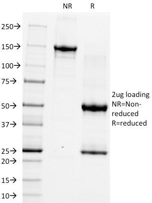 SDS-PAGE Analysis of Purified CD5 Monoclonal Antibody (CRIS-1). Confirmation of Integrity and Purity of Antibody.