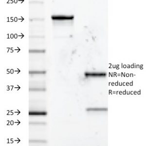 SDS-PAGE Analysis Purified CD5 Mouse Monoclonal Antibody (Clone B-B8). Confirmation of Integrity and Purity of Antibody.