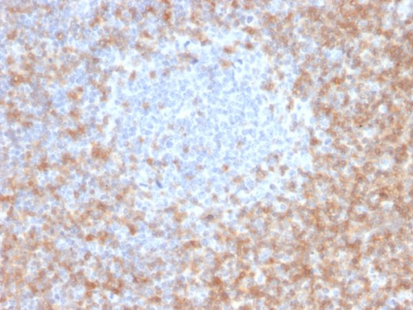 Formalin-fixed, paraffin-embedded human Tonsil stained with CD5-Monospecific Mouse Monoclonal Antibody (CD5/2416).