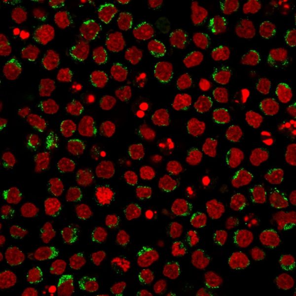 Immunofluorescent staining of PFA-fixed Ramos cells using CD5-Monospecific Mouse Monoclonal Antibody (CD5/2416) followed by goat anti-Mouse IgG conjugated to CF488 (green). Nuclei are stained with Reddot.