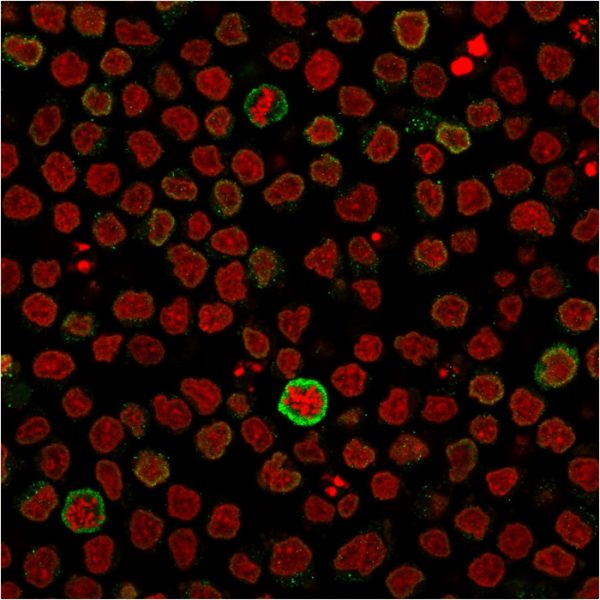 Immunofluorescent staining of PFA-fixed Ramos cells using CD5-Monospecific Mouse Monoclonal Antibody (CD5/2418) followed by goat anti-mouse IgG-CF488 (green). Nuclei are stained with RedDot.