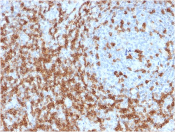 Formalin-fixed, paraffin-embedded human Tonsil stained with CD5 Mouse Monoclonal Antibody (CD5/2419).