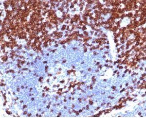 Formalin-fixed, paraffin-embedded human lymph node stained with CD5 Recombinant Rabbit Monoclonal Antibody (C5/4561R).