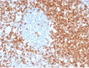 Formalin-fixed, paraffin-embedded human tonsil stained with CD5 Recombinant Rabbit Monoclonal Antibody (C5/6463R).