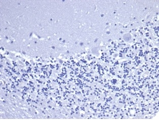 IHC analysis of formalin-fixed, paraffin-embedded human brain. Negative tissue control using C5/6463R at 2ug/ml in PBS for 30min RT. HIER: Tris/EDTA, pH9.0, 45min. 2 °: HRP-polymer, 30min. DAB, 5min.