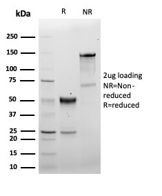 SDS-PAGE Analysis Purified CD5 Recombinant Rabbit Monoclonal Antibody (C5/6463R). Confirmation of Purity and Integrity of Antibody.