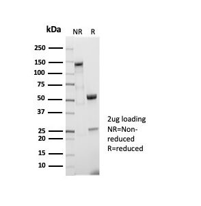 SDS-PAGE Analysis Purified CD5 Recombinant Rabbit Monoclonal Antibody (C5/7020R). Confirmation of Purity and Integrity of Antibody.