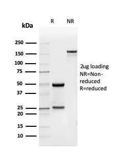 SDS-PAGE Analysis of Purified BMP15 Mouse Monoclonal Antibody (BMP15/4263) Confirmation of Integrity and Purity of Antibody.