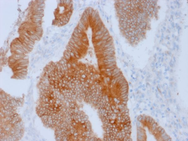 Formalin-fixed, paraffin-embedded human Colon stained with Aurora B Mouse Monoclonal Antibody (AURKB/1592).