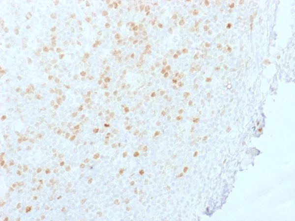 Formalin-fixed, paraffin-embedded human Tonsil stained with Aurora B Mouse Monoclonal Antibody (AURKB/1845).