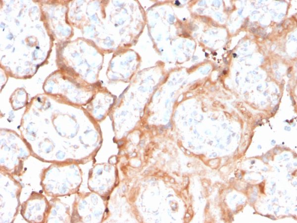 Formalin-fixed, paraffin-embedded human placenta stained with Aurora B Recombinant Mouse Monoclonal Antibody (rAURKB/1592).