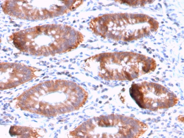 Formalin-fixed, paraffin-embedded human Colon stained with Aurora B Rabbit Recombinant Monoclonal Antibody (AURKB/3121R).