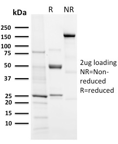 SDS-PAGE Analysis Purified Aurora B Rabbit Recombinant Monoclonal (AURKB/3121R). Confirmation of Purity and Integrity of Antibody.