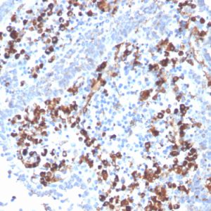 Formalin-fixed, paraffin-embedded human Tonsil stained with CD5L Mouse Monoclonal Antibody (CD5L/2991).