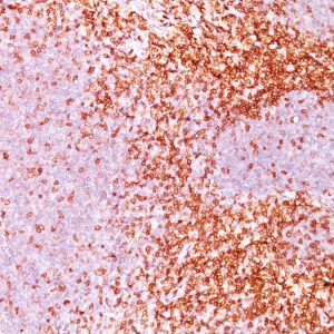 Formalin-fixed, paraffin-embedded human Tonsil (10X) stained with CD6 Monoclonal Antibody (3F7B5).