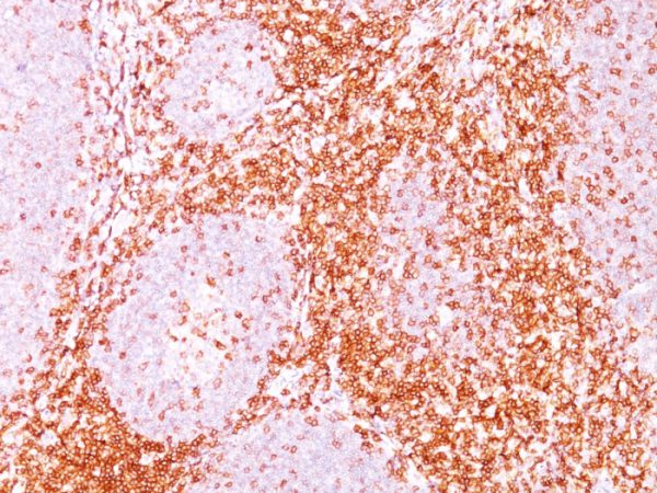 Formalin-fixed, paraffin-embedded human tonsil stained with CD6 Mouse Monoclonal Antibody (C6/372).