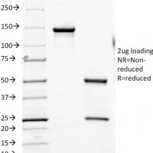 SDS-PAGE Analysis of Purified CD6 Mouse Monoclonal Antibody (SPV-L14).