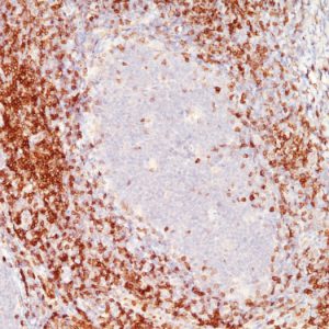Formalin-fixed, paraffin-embedded human Tonsil stained with CD6 Monoclonal Antibody (C6/372+3F7B5).