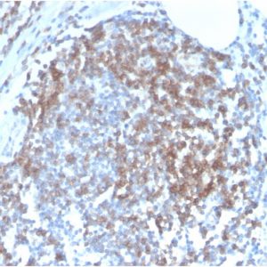 Formalin-fixed, paraffin-embedded human Tonsil stained with CD6 Rabbit Recombinant Monoclonal Antibody (C6/2884R).