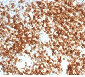 Formalin-fixed, paraffin-embedded human tonsil stained with CD6 Recombinant Rabbit Monoclonal Antibody (C6/7022R).