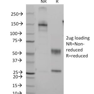 SDS-PAGE Analysis of Purified CD7 Mouse Monoclonal Antibody (Clone B-F12). Confirmation of Integrity and Purity of Antibody.