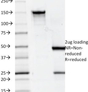 SDS-PAGE Analysis of Purified CD7 Mouse Monoclonal Antibody (124-1D1). Confirmation of Integrity and Purity of Antibody.