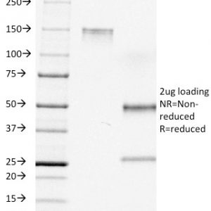 SDS-PAGE Analysis of Purified CD7 Mouse Monoclonal Antibody (C7/511). Confirmation of Integrity and Purity of Antibody.