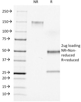 SDS-PAGE Analysis Purified CD7 Mouse Monoclonal Antibody (C7/511). Confirmation of Integrity and Purity of Antibody.