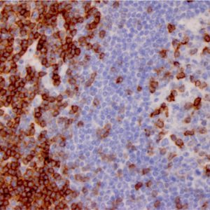 Formalin-fixed, paraffin-embedded human lymph node stained with CD7 Mouse Monoclonal Antibody (CD7/3737).