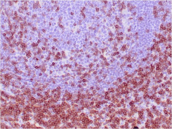 Formalin-fixed, paraffin-embedded human tonsil stained with CD7 Mouse Monoclonal Antibody (CD7/3737).
