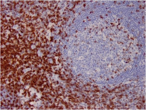 Formalin-fixed, paraffin-embedded human lymph node stained with CD7 Mouse Monoclonal Antibody (CD7/3737).