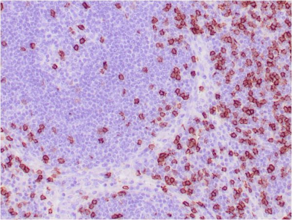 Formalin-fixed, paraffin-embedded human tonsil stained with CD8 Mouse Monoclonal Antibody (C8/468).