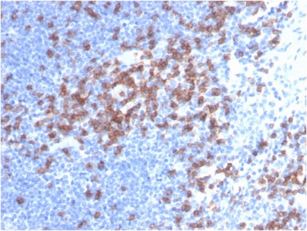 Formalin-fixed, paraffin-embedded human lymph node stained with CD8a Mouse Monoclonal Antibody (C8/468).