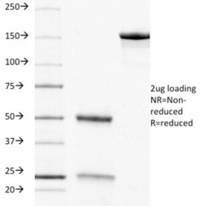 SDS-PAGE Analysis of Purified CD8 Mouse Monoclonal Antibody (C8/468). Confirmation of Integrity and Purity of Antibody.