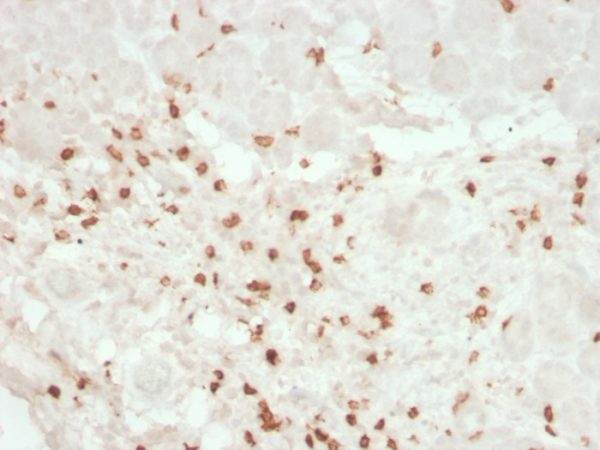 Formalin-fixed, paraffin-embedded human colon stained with CD8 Mouse Recombinant Monoclonal Antibody (rC8/468).