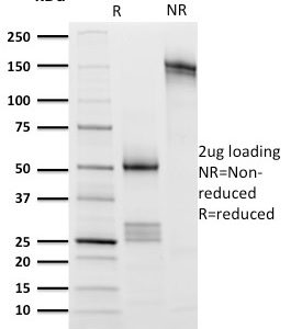 SDS-PAGE Analysis Purified CD8 Mouse Monoclonal Antibody (UCHT4). Confirmation of Purity and Integrity of Antibody.