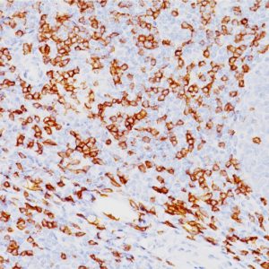 Formalin-fixed, paraffin-embedded human tonsil stained with CD8a Mouse Monoclonal Antibody (SPM548).
