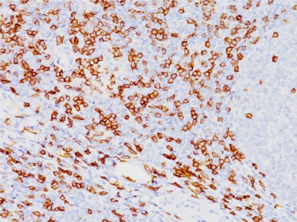 Formalin-fixed, paraffin-embedded human tonsil stained with CD8a Mouse Monoclonal Antibody (SPM548).