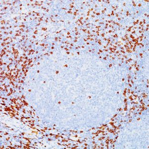 Formalin-fixed, paraffin-embedded human Tonsil stained with CD8A Mouse Monoclonal Antibody (C8/144B).