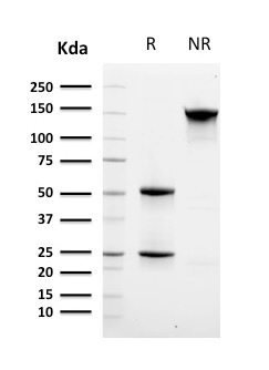 SDS-PAGE Analysis of Purified CD8 Mouse Monoclonal Antibody (C8/468 + C8/144B). Confirmation of Integrity and Purity of Antibody.