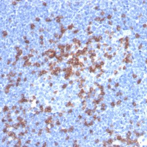 Formalin-fixed, paraffin-embedded human lymph node stained with CD8a Recombinant Rabbit Monoclonal Antibody (CD8/4391R).