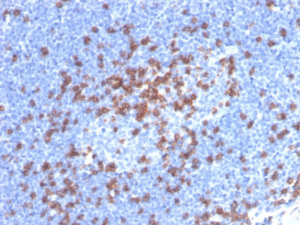 Formalin-fixed, paraffin-embedded human lymph node stained with CD8a Recombinant Rabbit Monoclonal Antibody (CD8/4391R).